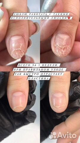 Маникюр, педикюр, подология