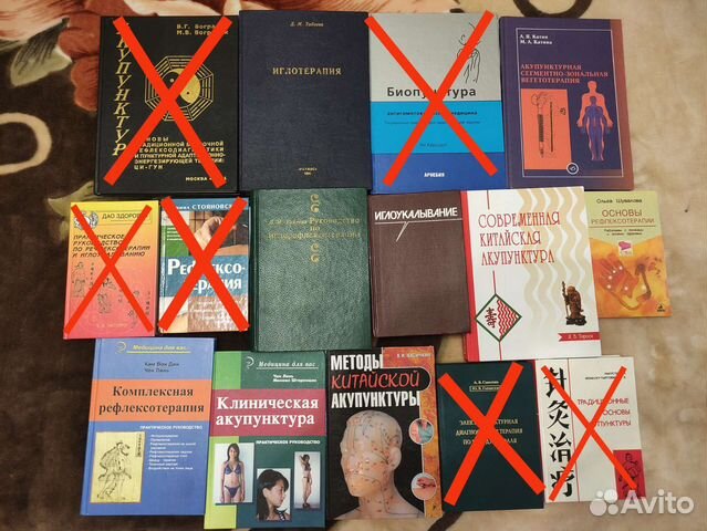 Акупунктура Иглоукалывание Иглорефлексотерапия